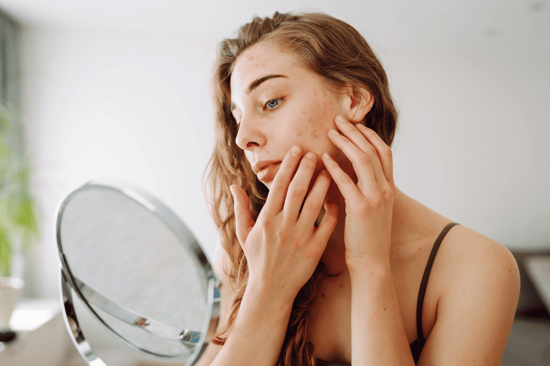 Signs Your Skin Barrier Might Be Damaged
