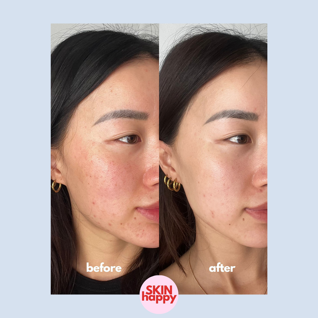 Skin Happy Hypochlorous Acid Face & Body Spray