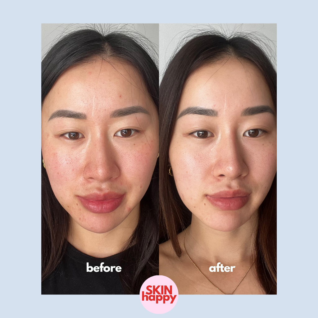 Skin Happy Hypochlorous Acid Face & Body Spray