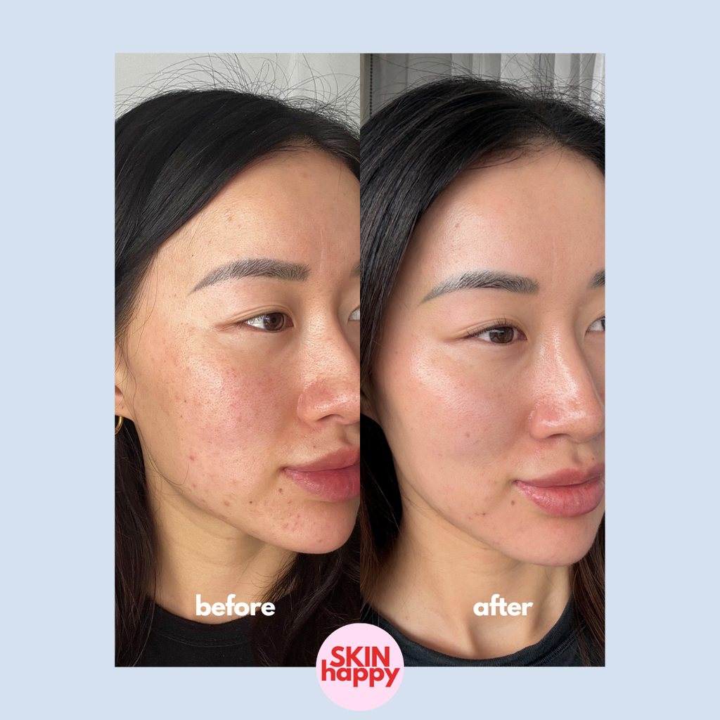Skin Happy Hypochlorous Acid Face & Body Spray