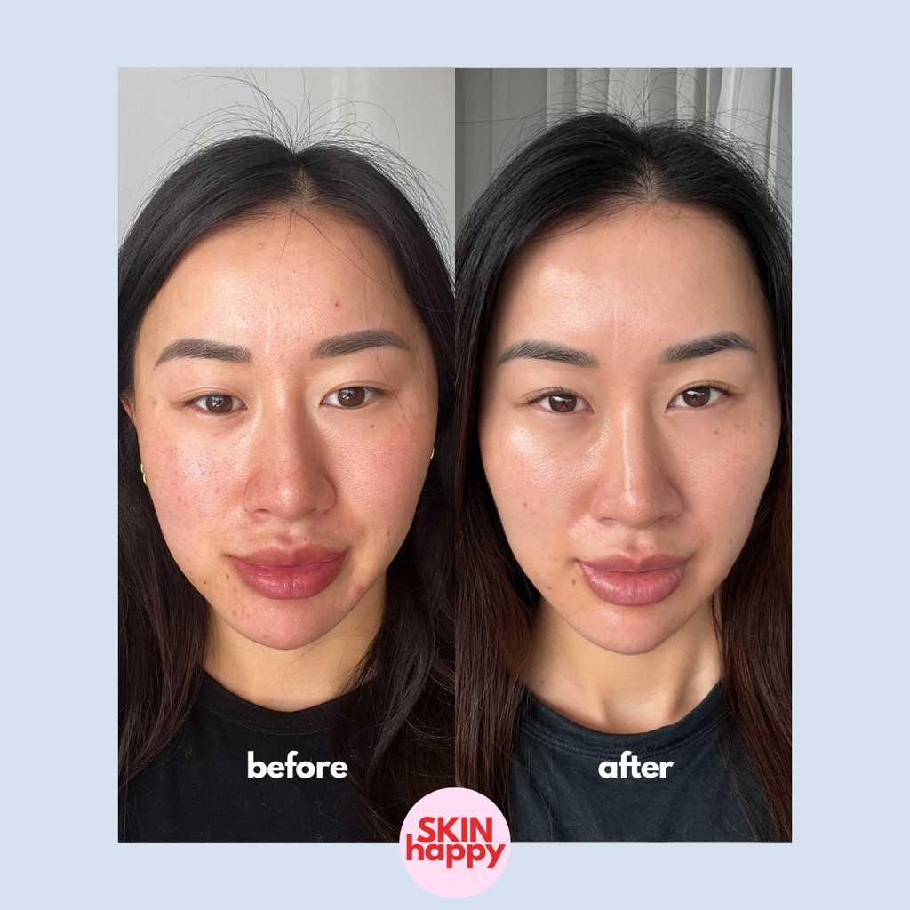 Skin Happy Hypochlorous Acid Face & Body Spray