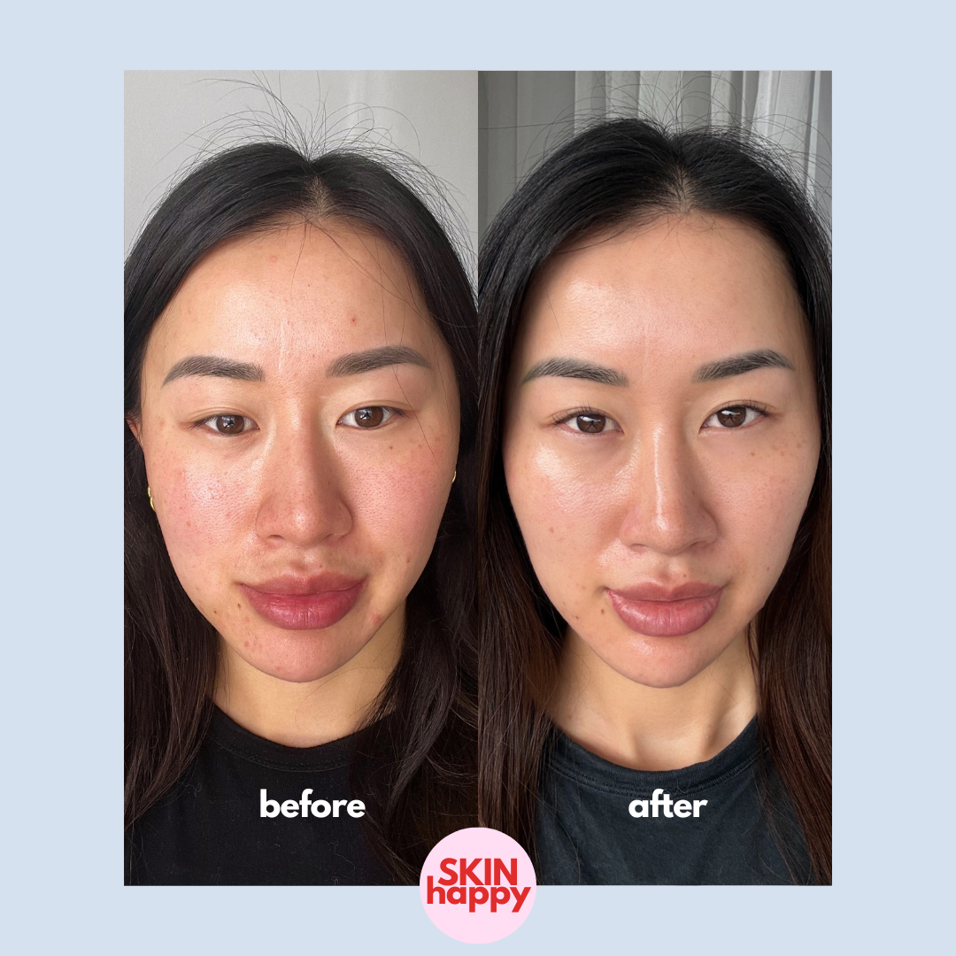 Skin Happy Hypochlorous Acid Face & Body Spray